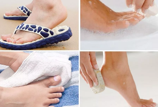 Measures for the prevention of fungal infections